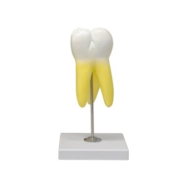 Viršutinio krūminio danties modelis, trijų šaknų